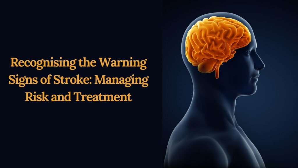 Recognising the Warning Signs of Stroke: Managing Risk and Treatment